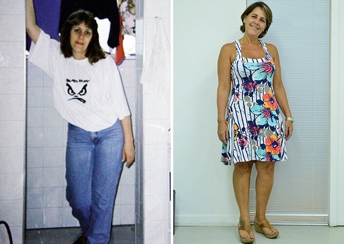 Cristina Cancian revela que ela, a mãe e a filha sofrem de varizes