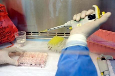 A origem da doença renal ainda é incerta