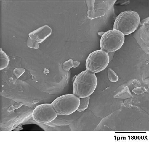 Bactéria aproveita feridas para se instalar no corpo dos pacientes