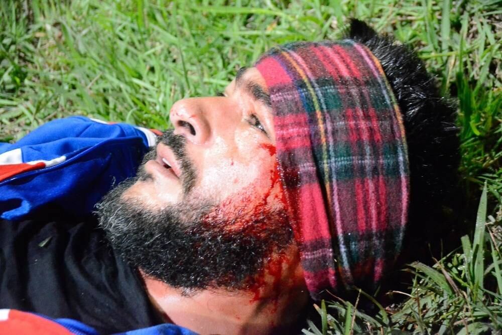 Cinegrafista atropelado teve ferimentos na cabeça