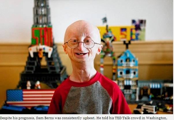 As crianças com progeria vivem em média 13 anos, de acordo com a fundação