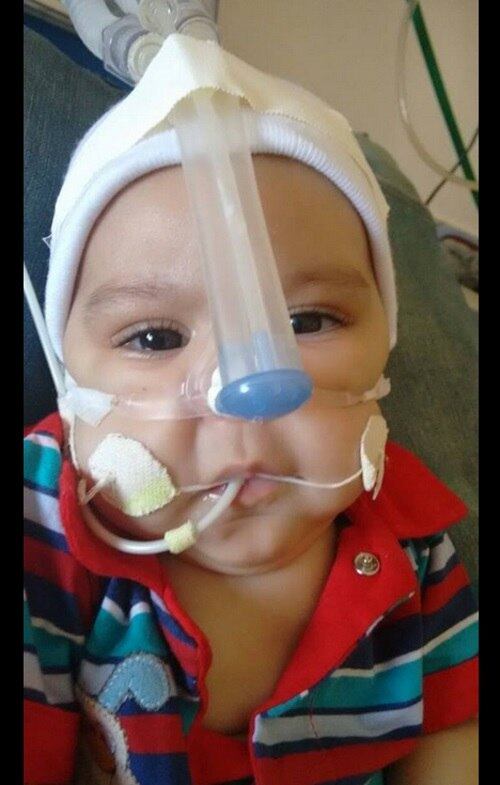 A mãe
conta que Miguel não possui nenhum problema nos pulmões, mas que, por não ter
força muscular, o bebê precisa de aparelhos para conseguir respirar.  
— Ele não tem problema
respiratório, mas a dificuldade do funcionamento muscular dificulta a respiração.
Ele precisa usar uma máscara 24 horas para conseguir respirar