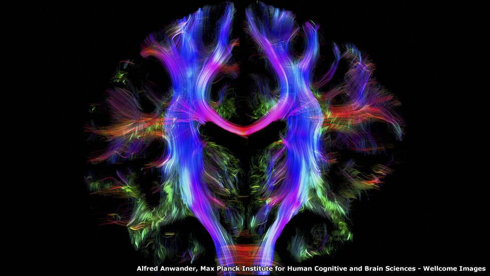 A partir do mapeamento de fatias virtuais do cérebro, essa imagem foi criada com uma técnica ligada a ressonância magnética. Um caleidoscópio de cores registra um mapa de caminhos de dentro do cérebro de um adulto saudável. Na foto, é possível perceber que partes diferentes do cérebro se comunicam com outras por meio de fibras nervosas. O autor da imagem foi Alfred Anwander, que rastreou a direção e o movimento das moléculas de água 