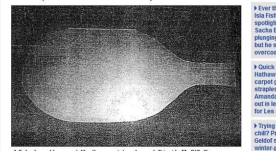 O inglês Michael O’Sullivan, de 49 anos, passou por uma cirurgia de transplante de fígado e ganhou algo extra na sua barriga. Os médicos esqueceram um instrumento
cirúrgico que só foi descoberto três semanas depois por causa de fortes dores abdominais