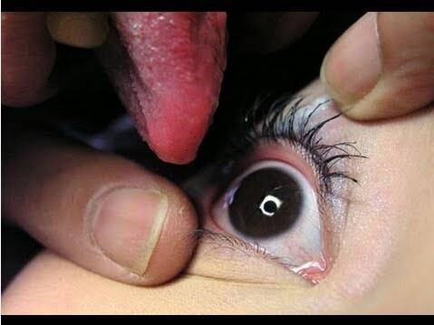 Apesar da nova mania, que teria começado a partir de um clipe
de música do país, especialistas afirmam que o ato pode causar diversas doenças,
como conjuntivite e clamídia de olho
