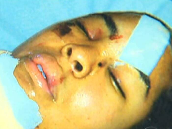 A mulher que foi jogada na frente de um trem do metrô de SP está internada na (Unidade de Terapia Intensiva) em estado estável. Ela está consciente e respira sem ajuda de aparelhos. Em entrevista ao Cidade Alerta, Kléber Siqueira, marido da vítima lamentou o ocorrido.— Prefiro ela sem braço, mas com coração funcionando, diz o marido de Maria da Conceição Oliveira.