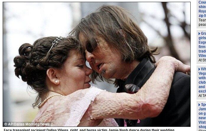 Wiens ficou gravemente ferido em um acidente em uma construção,
em 2008. Ele entrou em contato com uma linha de alta tensão enquanto pintava as
paredes da igreja, deixando-o cego e com o rosto queimado