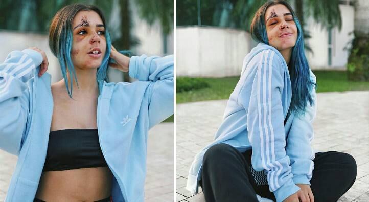 Jully Molinna bateu com o veículo contra uma árvore