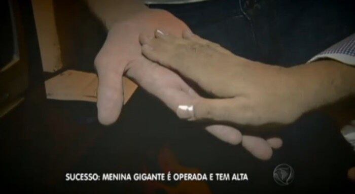 Por isso, ela deverá passar ainda por duas cirurgias. O gigantismo não tem cura, mas pode ser controlada