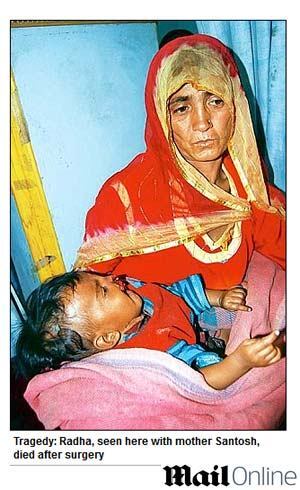 Criança passou por cirurgia reconstrutiva, mas não resistiu aos ferimentos e morreu hoje