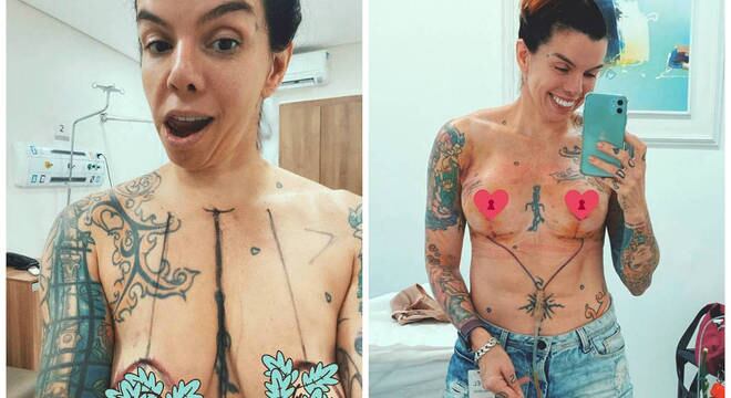 Penélope Nova mostra antes e depois de cirurgia nos seios