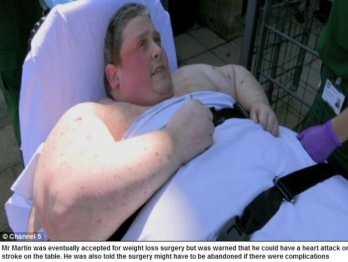 Em breve, ele passará por uma cirurgia de redução de peso. Mas para isso ele precisa perder peso. Desde janeiro, faz uma dieta rigorosa
