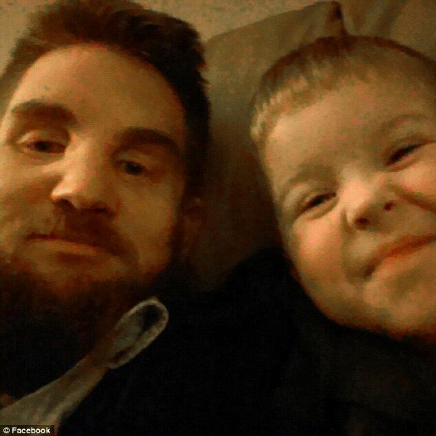 Até 2011, apenas dois transplantes de rosto bem-sucedidos haviam sido realizados nos Estados Unidos — no mundo, o total eram de 10 operações