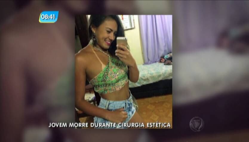 Uma jovem de 21 anos morreu após passar por um procedimento de cirurgia plástica em uma clínica na Barra da Tijuca, zona oeste do Rio. Segundo familiares, Catarina Cruz estava animada com os preparativos do casamento e a cirurgia fazia parte do planejamento, já que queria tirar gordura que a incomodava nas costas. O amigo da vítima disse que o médico mentiu sobre ter uma UTI (Unidade de Tratamento Intensivo) na clínica preparada para o caso de uma eventual emergência