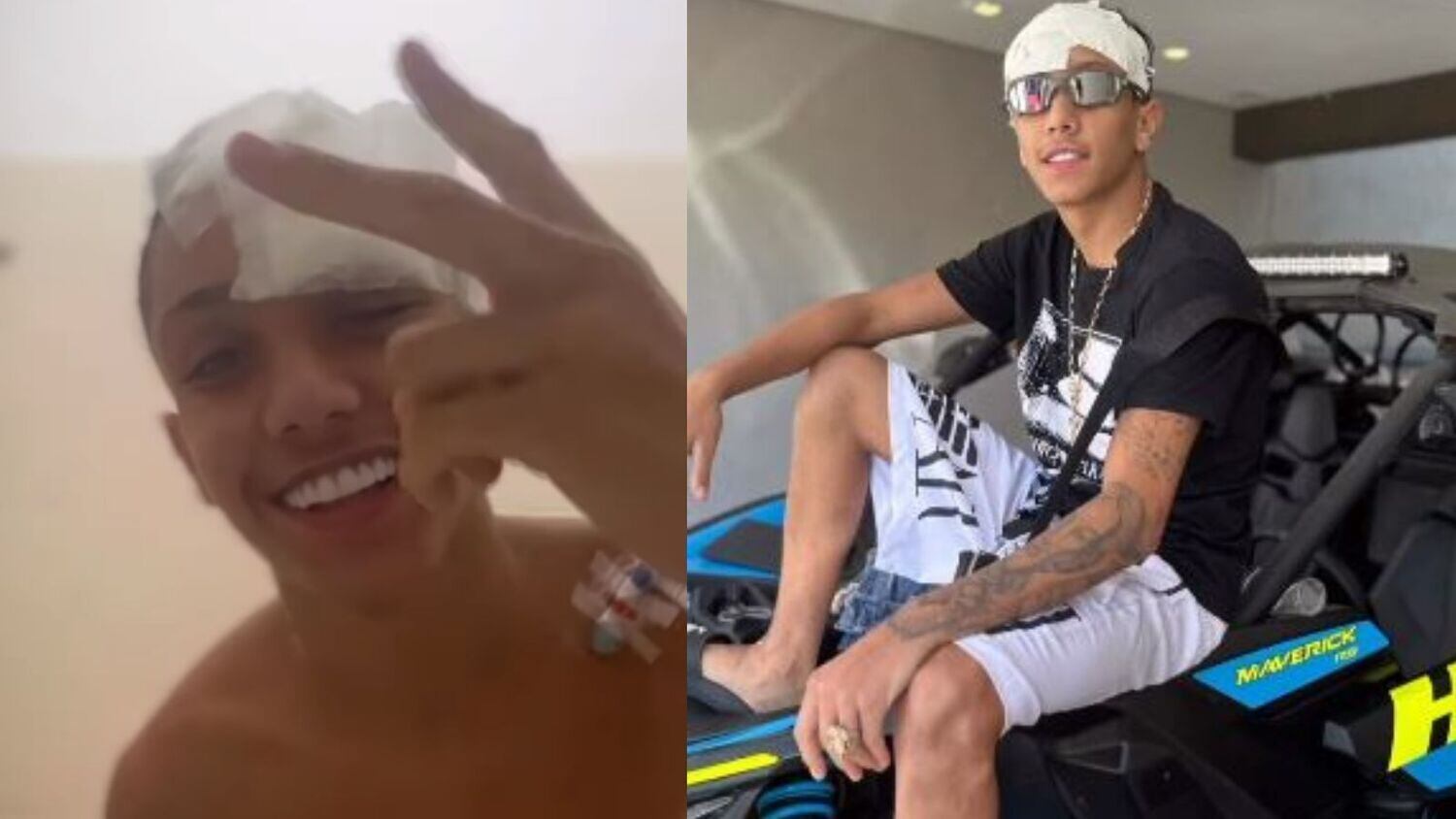 Meno Kabrinha precisou passar por cirurgia na cabeça