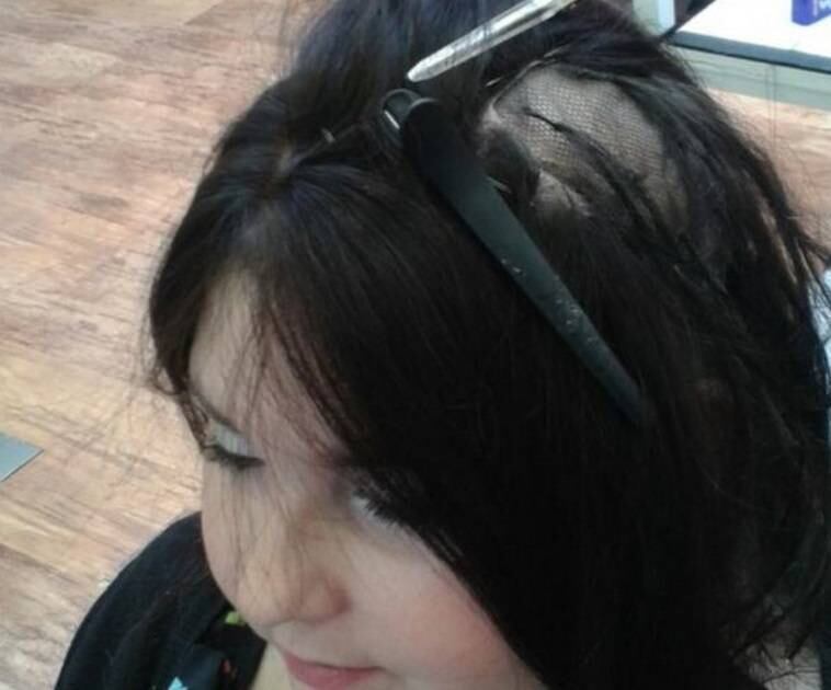 A jovem ganhou o implante de um especialista em perda de
cabelo, após seu drama ter sido contado no Daily Mail em dezembro.
— Quando recebi o telefonema que havia ganhado o
tratamento, fiquei chocada. Estou muito satisfeita. Parece que já faz parte de
mim. É incrível