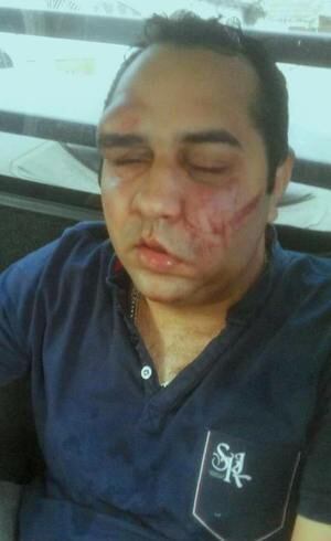 Jovem foi agredido por cantor sertanejo