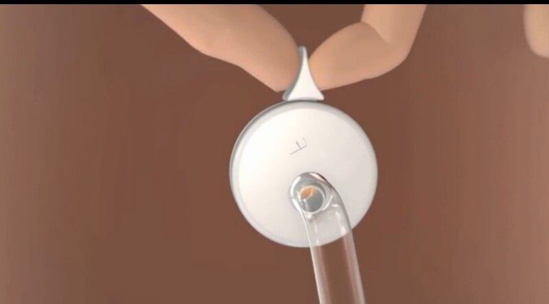 Anthony
Shonde, gastroenterologista que criou o aparelho, afirma que o funcionamento
é praticamente o mesmo de uma cirurgia de redução de estômago, mas sem os
riscos da operação