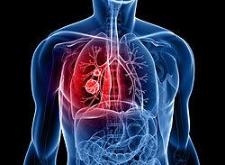 Cientistas fazem mapeamento genético de câncer