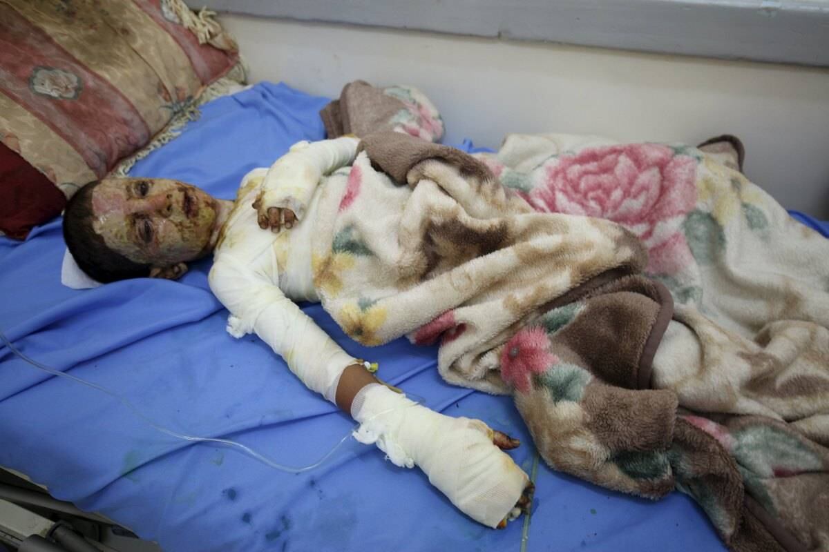 — A situação humanitária não é nada menos que catastrófica. Cada uma das famílias do Iêmen foi afetada por esse conflito
