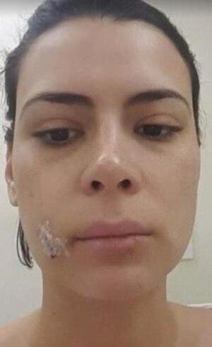 Michelle levou 20 pontos