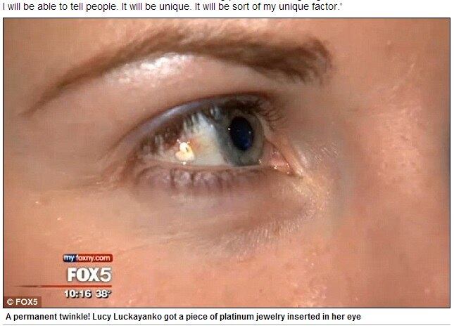Você já imaginou ter uma joia dentro do olho? A jovem Lucy Luckayanko,
de 25 anos, de Nova York, implantou um coração feito de platina no canto do
olho direito. A joia mede 3,5 mm e custou cerca de R$ 7.000 (U$S 3.000). De
acordo com o médico Emil Chynn, o procedimento é seguro e rápido. O corte no
globo ocular é bem pequeno, por isso nem precisa de pontos para cicatrizar

