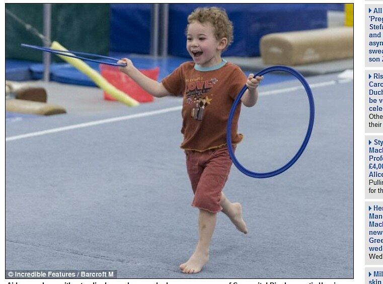 

Aiden
nasceu com um caso grave de hérnia diafragmática congênita — desenvolvimento
anormal do diafragma que incluem defeitos cardíacos, trissomias e síndromes bem
definidas. Essa condição provoca uma espécie de “buraco” no corpo

Condição rara deixa homem 'com o cérebro para o lado de fora'