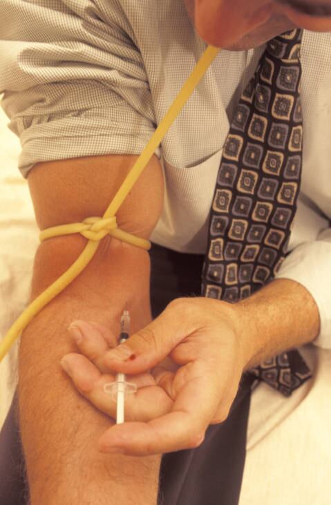 A Aids é a mais perigosa das doenças
sexuais, porque ainda não tem cura e deixa o corpo debilitado. Para o
médico, quanto mais DSTs uma pessoa tem, mais fácil de contrair o HIV. Esse
vírus ataca as células de defesa do corpo, deixando o organismo vulnerável a
outras doenças simples, como resfriado, e infecções mais graves, como a
tuberculose.
 
Pesquisa recente divulgada em
janeiro deste ano pelo Ministério da Saúde mostra
que quase 50% dos jovens não usou camisinha em suas relações casuais nos
últimos 12 meses. O infectologista da Unifesp comenta que o dado é preocupante.


— Fiquei alarmado. É justamente nas
relações casuais que está o risco de contaminação. Trocar muito de parceiro sem
se proteger é muito perigoso