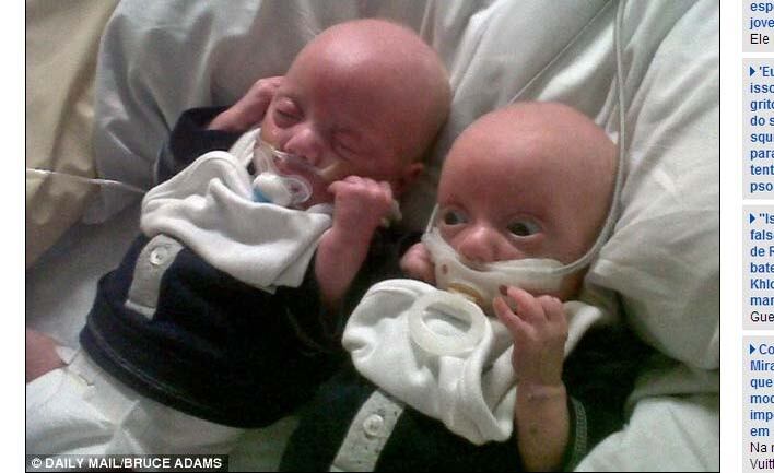 O caso revoltou a mãe dos gêmeos Mason (esquerda) e Reece, Sarah Fellows. Sarah recebeu um telefonema informando que seu filho prematuro, de apenas quatro meses, estava com uma chupeta grudada em sua boca com fita cirúrgica. O bebê precisava lutar para respirar com o objeto em sua boca