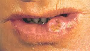 Ele tem dificuldades para comer e reaprendeu a falar, sem conseguir ainda pronunciar algumas palavras. Ainda faltam procedimentos cirúrgicos mas ele tem esperanças de que o pior já passou
Conheça o R7 Play e assista a todos os programas da Record
na íntegra!