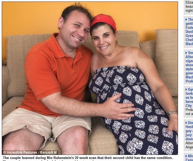 O tratamento consiste em uma cirurgia em que o músculo é costurado. No
entanto, esse tipo de procedimento pode trazer consequências, como hipertensão
pulmonar — pressão alta nos vasos sanguíneos que suprem os pulmões. Quem sofre
deste problema sente dificuldades em respirar de forma independente. De acordo
com os médicos, a doença não é genética

Doença rara deixa menino sem ver, falar e se movimentar