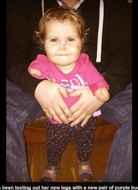 Freya Hall, 22, e Ross Allen, de 24 anos, acharam que sua
filha não sobreviveria, mas ela conseguiu vencer a
bactéria