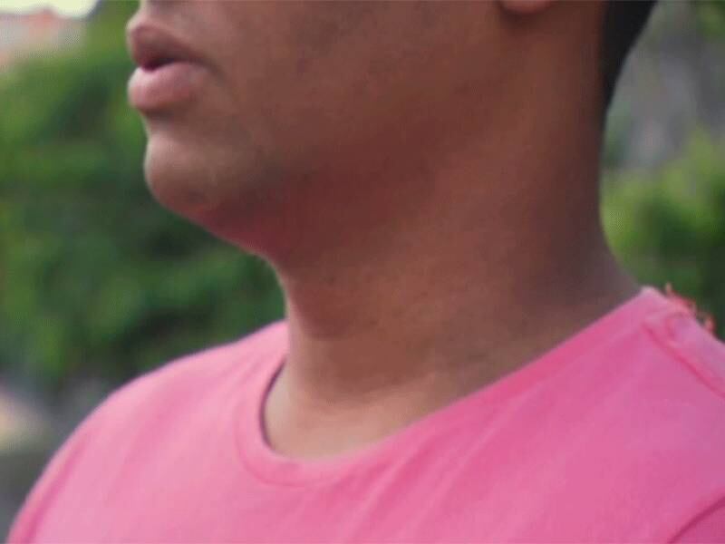 Soldado vai precisar tomar remédios contra hepatite e HIV