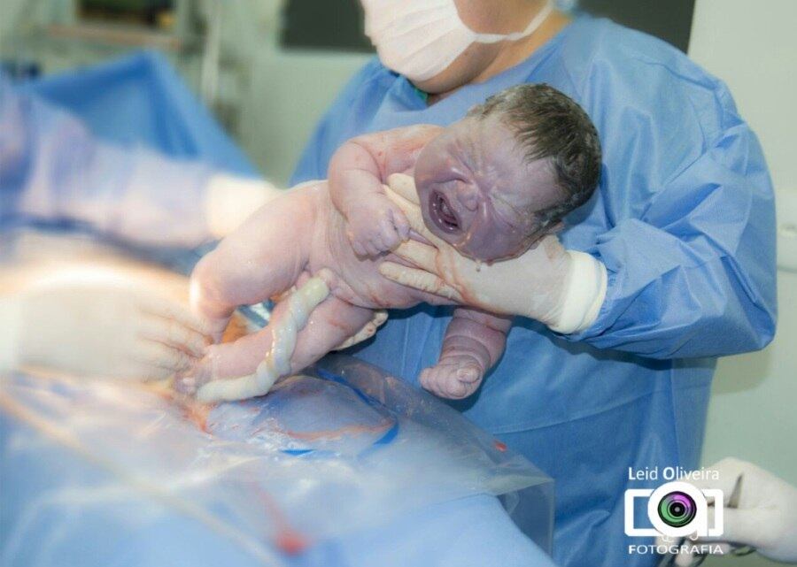 

O endócrino-pediatra Luis Eduardo Calliari, professor da
Faculdade de Medicina da Santa Casa de São Paulo, afirma que com esse peso, o
bebê precisa de acompanhamento médico e orientação nutricional, especialmente
nos primeiros dois anos de vida, para evitar o ganho de peso excessivo.


— Isso pode aumentar o risco do aparecimento de doenças
metabólicas, como obesidade, diabetes e hipertensão, no futuro.



Eliane e Isadora deverão ter alta nesta
quinta-feira

(22) ou sexta-feira (23).

A nutricionista já é mãe de uma
outra menina, Isabella, de 12 anos

 

