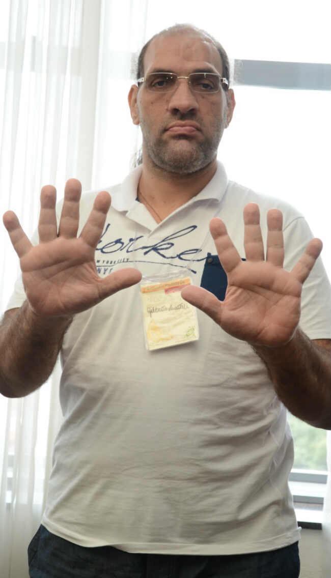 Há mais de 20 anos, Gilberto Lucateli, 41 anos, vive entre a vida e a morte. Tudo porque descobriu dez anos após os primeiros sintomas que sofre com uma doença rara sem cura chamada acromegalia, um tipo de gigantismo que acomete adultos