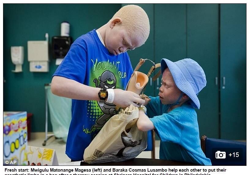 Após terem sido violentamente atacadas por feiticeiros na Tanzânia, país localizado no sudeste do continente africano, cinco crianças albinas vão voltar para o país após passarem uma temporada nos Estados Unidos