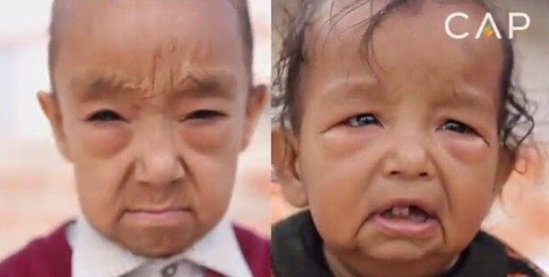 Anos depois eles tiveram Keshav, com a mesma condição e, por não terem dinheiro, nem procuraram o médico para o filho, segundo a mãe
Conheça o R7 Play e assista a todos os programas da Record
na íntegra!