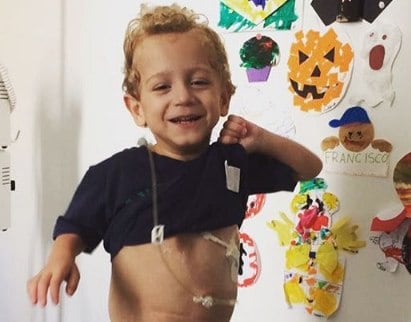 A dona de
casa Jéssica Marzola lançou campanha para arrecadar R$ 400 mil para arcar com
as despesas de uma cirurgia chamada Lilt (Alongamento Intestinal Longitudinal),
realizada no Royal Manchester Children’s Hospital, em Manchester, na Inglaterra,
para o filho de quatro anos, que nasceu com gastrosquise. Jéssica conta ter descoberto
a má-formação nos primeiros meses de gravidez, durante exame de ultrassom. Na época,
o médico explicou que bastava colocar o intestino para dentro e o menino
receberia alta em poucos dias. Mas a situação de Chico se complicou porque,
assim que ele nasceu, perceberam que boa parte do órgão estava necrosada e
precisava ser retirada imediatamente.
— Eles tiraram
o intestino necrosado e ele ficou com a síndrome do intestino curto. Mais tarde,
ele fez mais duas cirurgias aqui no Brasil para alongar o órgão. Na última vez,
ele ficou com aproximadamente 50 cm.
A desvantagem
da cirurgia de alongamento feita no Brasil é o fato de não ser definitiva