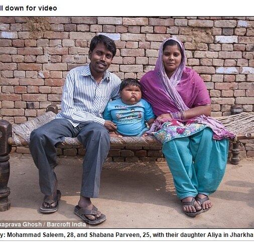 Aliya já nasceu grande, pesando 5,7 kg, mas a partir dos quatro meses de idade começou a ganhar peso rapidamente. Os pais estão preocupados com a saúde da filha, especialmente porque um de seus irmãos morreu com apenas um ano e meio depois de engordar de forma semelhante