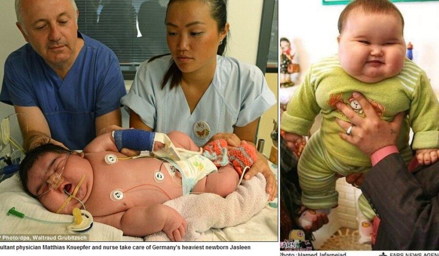 

Sabia
que recém-nascidos com mais de 4 kg têm mais chances de apresentar sobrepeso na
vida adulta se não tiverem acompanhamento nutricional? Conheça os bebês
candidatos a fazerem parte desta estatística



Parto normal feito por Kate Middleton é menos dolorido que cesariana, diz especialista