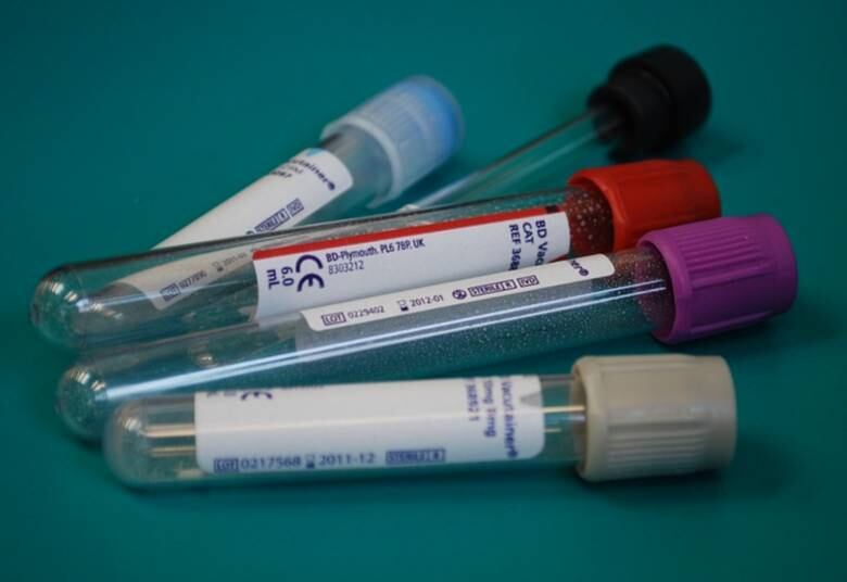 Apesar de ter regulamentação definida pela Agência Nacional de Saúde (ANS) as regras ainda deixam dúvidas e muitos pacientes inseguros