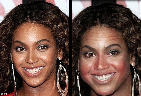 Após de dez ingeriando álcool, a cantora americana Beyoncé ficaria com o rosto bem inchado. Por ser rico em calorias, o álcool engorda. Para se ter uma ideia, o álcool tem 7 kcal/g e só perde para as gorduras (9
kcal/g), superando proteínas e carboidratos (4 kcal/g) e fibras (2 kcal/g)