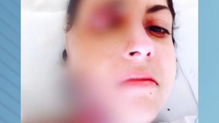 Bárbara teve 40% do corpo queimado, passou por mais de 200 cirurgias de reconstituição e ainda perdeu a filha de 2 anos e o bebê de três meses. Um vizinho que tentou ajudar a mulher também morreu