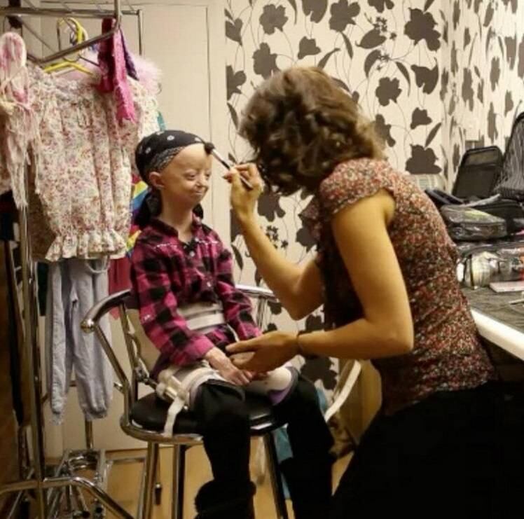 

Ela ainda revela que sente dores e problemas, mas ainda é uma
adolescente normal.



— Quero usar roupas lindas, usar maquiagem e sair com meus
amigos

