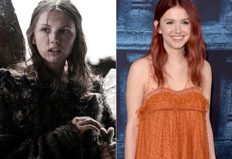 A pobre Gilly tem um olhar perdido e precisa lutar pela sua vida todos os dias. Mas, na vida real, a atriz Hannah Murray impressiona pela beleza e sorrisão, sem falar no cabelo ruivo