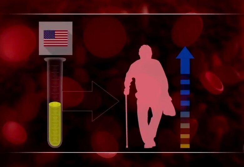 Segundo a empresa americana que oferece o tratamento, as
proteínas que estão presentes no plasma de doadores jovens seriam capazes de
melhorar a saúde de organismos mais velhos. Apenas o plasma do sangue é vendido