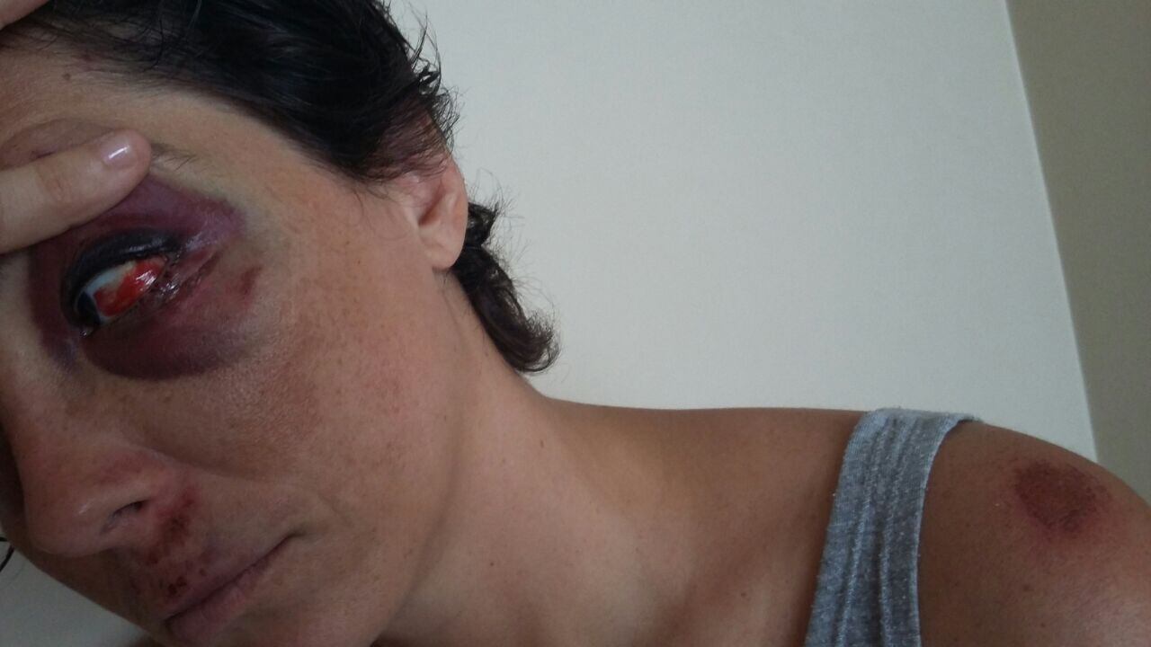 A fotógrafa conta que ficou surpresa com o valor da cobrança, mas que tirou todo dinheiro que tinha no bolso, R$ 200, e entregou à Sylvia Keller, organizadora do evento. Mas Roberta achou o valor cobrado absurdo e pediu que fosse feito um orçamento para avaliar o prejuízo. Caso o resultado fosse superior ao valor deixado pelas duas, elas se comprometeram a pagar a diferença depois
