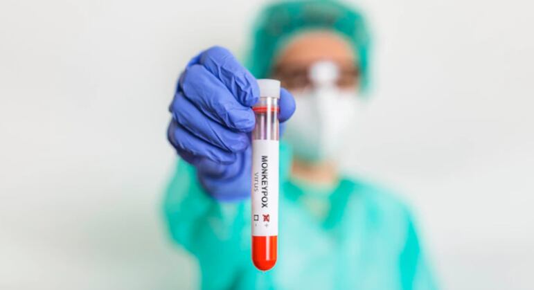 Espera por medicamento contra mpox causou cegueira em dois pacientes