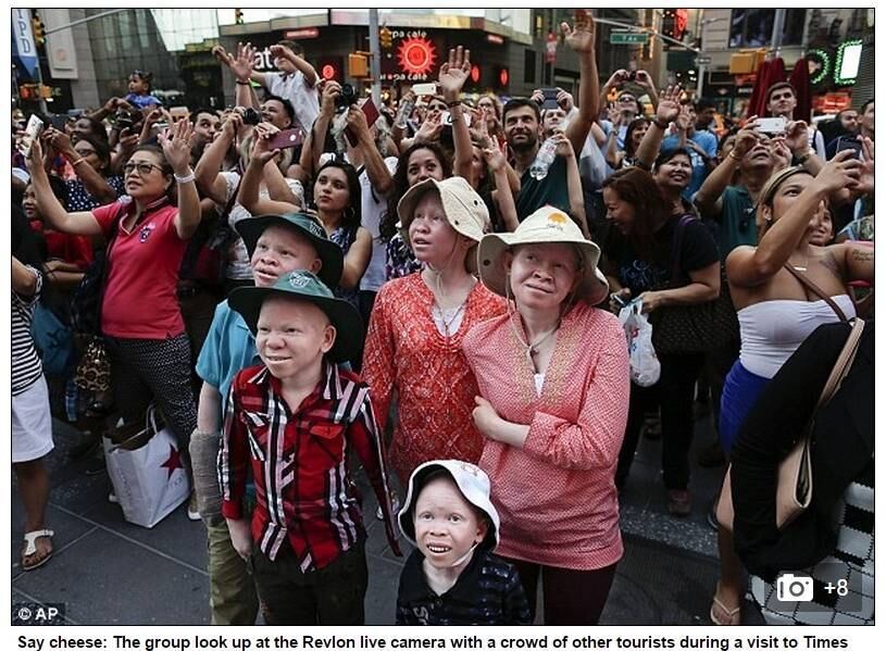 Os cinco albinos passaram o verão na casa de Nova York de Elissa Montanti, fundadora da instituição, e foram submetidos ao processo de adaptação ao uso das novas próteses
