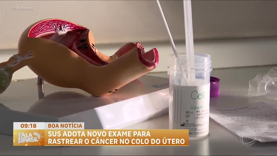 Boa Notícia: SUS implementa tecnologia para detecção do câncer de colo de útero